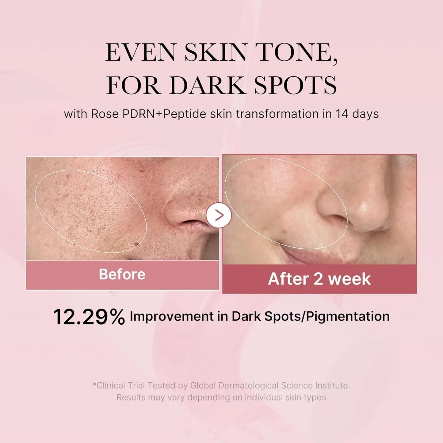 Medicube PDRN Pink Niacinamide Milky Toner
